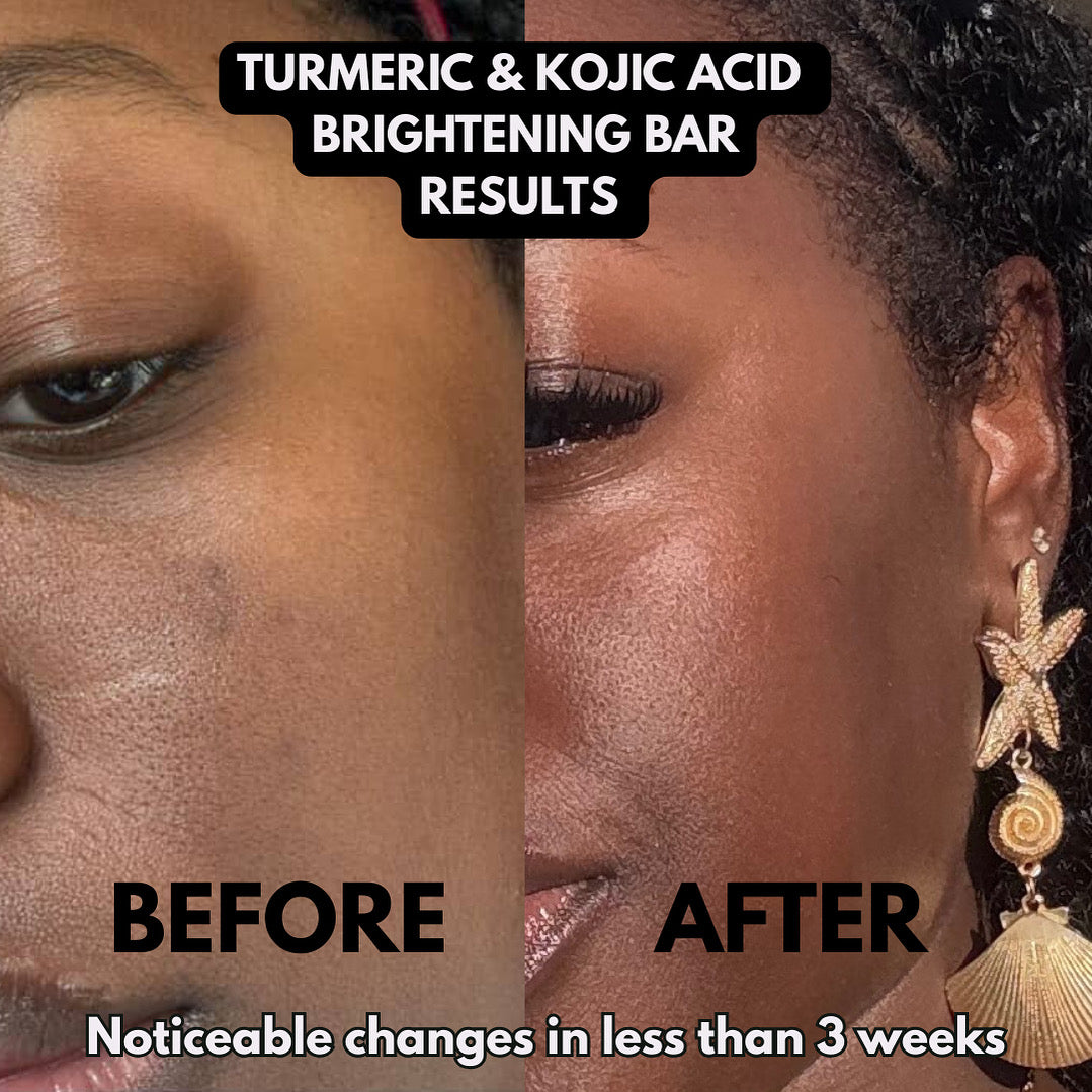 Turmeric & Kojic Acid Brightening Soap