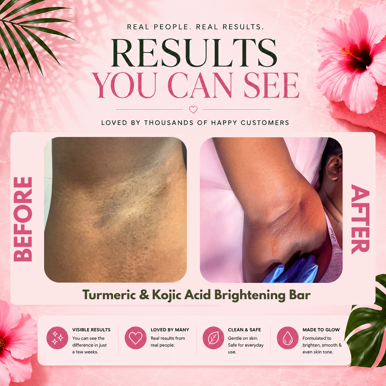 The Phresh Skin Repair Bundle