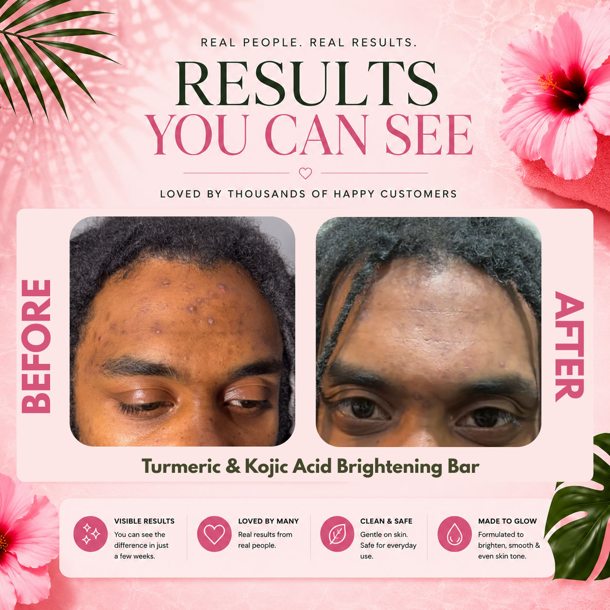 The Phresh Skin Repair Bundle